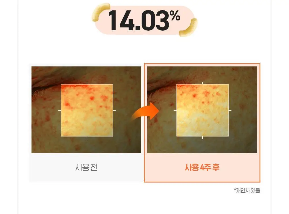 [생기충전][대용량] 빌리프X바나나킥 비타C 토닝 세럼 50ml 기획 (+비타팩 25ml, 스트레스볼 증정) 상세페이지 21